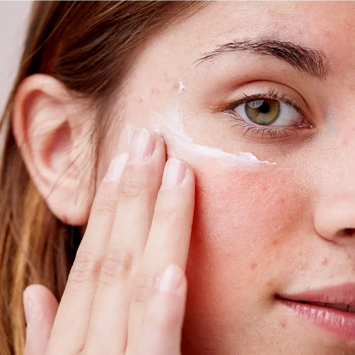 Horse-Chestnut-Extract-Reducing-Redness Horse-Chestnut-Extract-Reducing-Redness